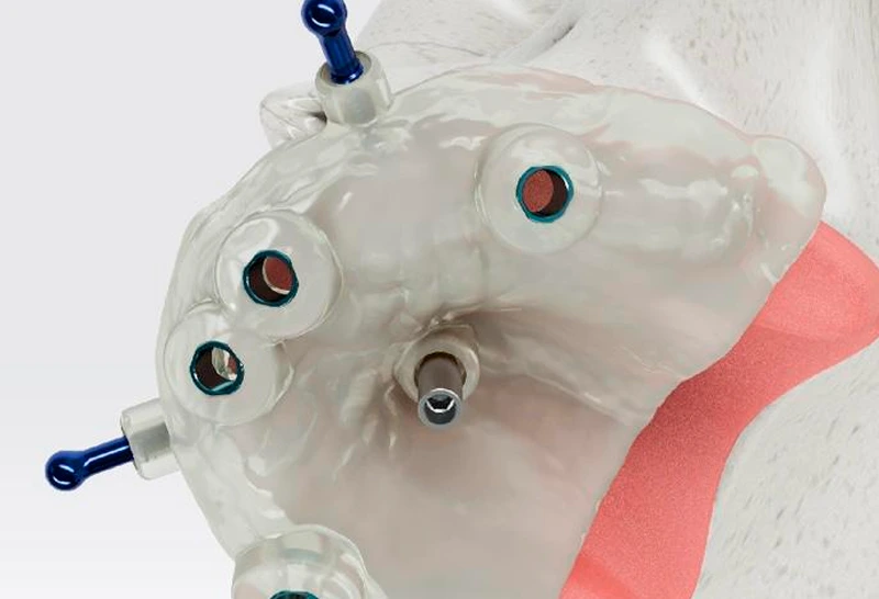 Credenciamento em Cirurgia Guiada