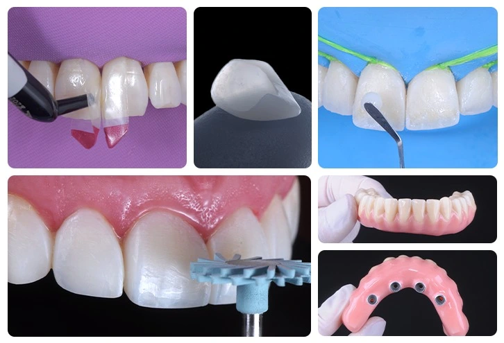 Dentística-Prótese