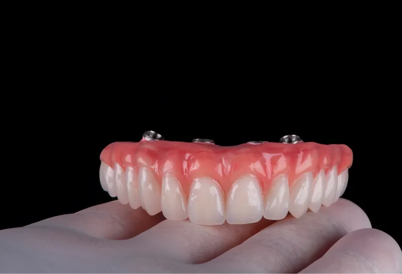 Reabilitação de Maxila